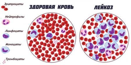 У телят обнаружили лейкоз